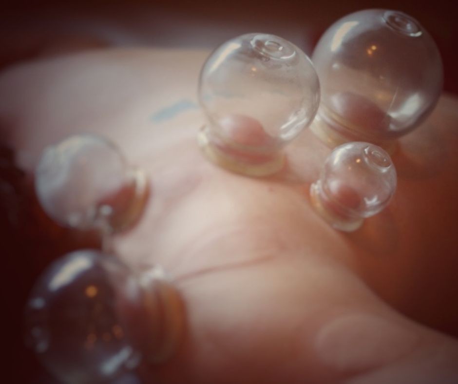 blog post what is cupping how it works jennifer raye